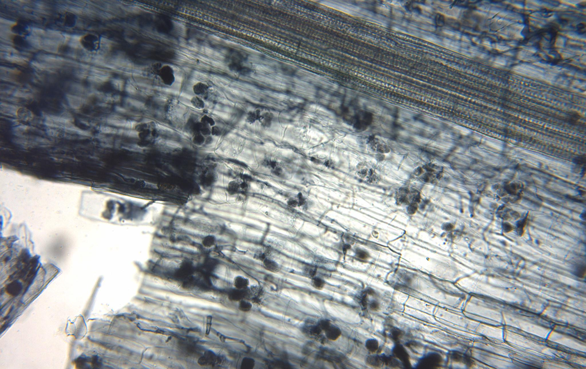 Mycorrhizae Under Microscope